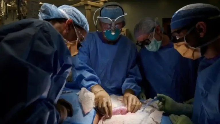 17 ವರ್ಷದ ಬಾಲಕಿಗೆ ಹೊಸ ಜೀವನ: ವೈದ್ಯಲೋಕದ ಅಪರೂಪದ ಯಶಸ್ವಿ ಶಸ್ತ್ರಚಿಕಿತ್ಸೆ