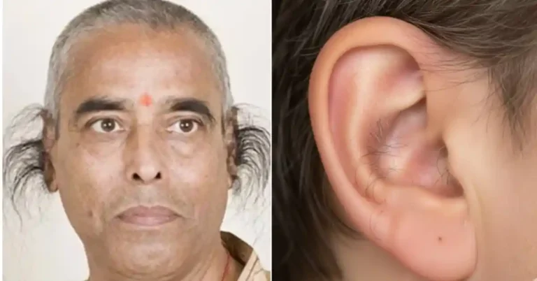 ಪುರುಷರ ಮೂಗು-ಕಿವಿಯಲ್ಲಿ ಕೂದಲು ಏಕೆ ಬೆಳೆಯುತ್ತದೆ? ಇದಕ್ಕಿದೆ ಆರೋಗ್ಯಕರ ಕಾರಣ!